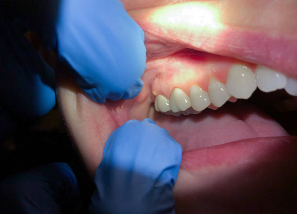 Best Walk-In Emergency Dentist in North Granby, CT