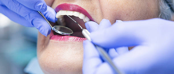 Best Emergency Tooth Extraction in North Granby, CT